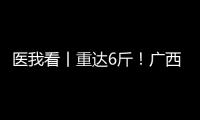 医我看丨重达6斤！广西女子乳腺肿瘤2年疯长至篮球大，医生提醒
：这些情况务必重视