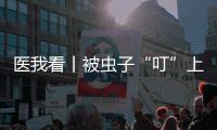 医我看丨被虫子“叮”上 ，发现“高烧和焦痂”？别大意�，这样急救
！