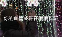 你的血管或许在悄悄长斑！这样做，“斑块”可能缩小→
