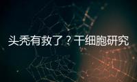 头秃有救了
？干细胞研究阐明压力如何影响毛发生长