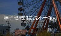 脖子黑黑的总洗不干净可能是病了，这些疾病信号赶紧自查